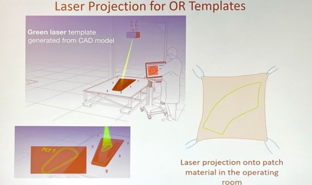 Laser cutter cuts the heart patches projected onto 2D from the heart model.