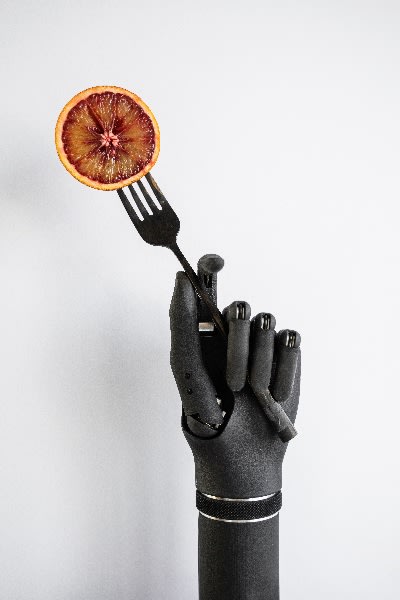 The Esper Hand gripping a fork. (Image courtesy of Esper Bionics.)