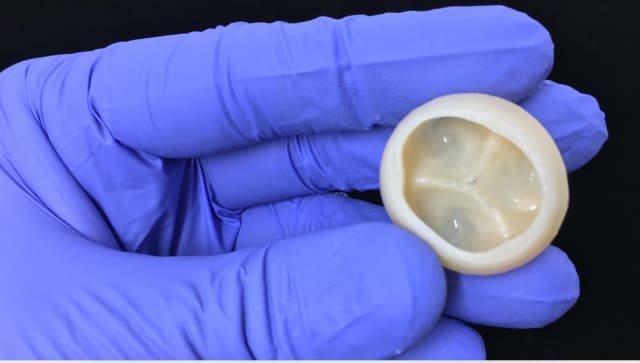 FRESH technology enables the 3D printing of collagen to create complex components of the human heart, from small blood vessels to ventricles. (Image courtesy of FluidForm.)